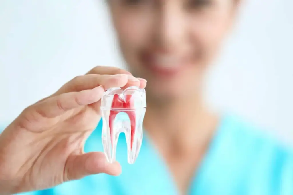 How to Care for Your Teeth After Root Canal Treatment