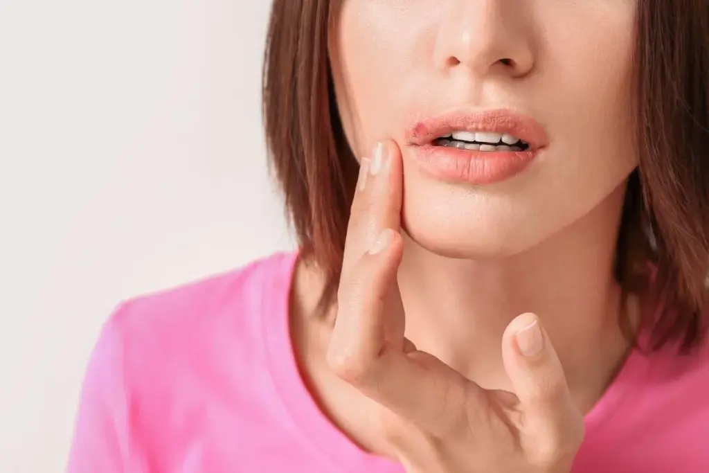 How to Care for Teeth After Braces Removal